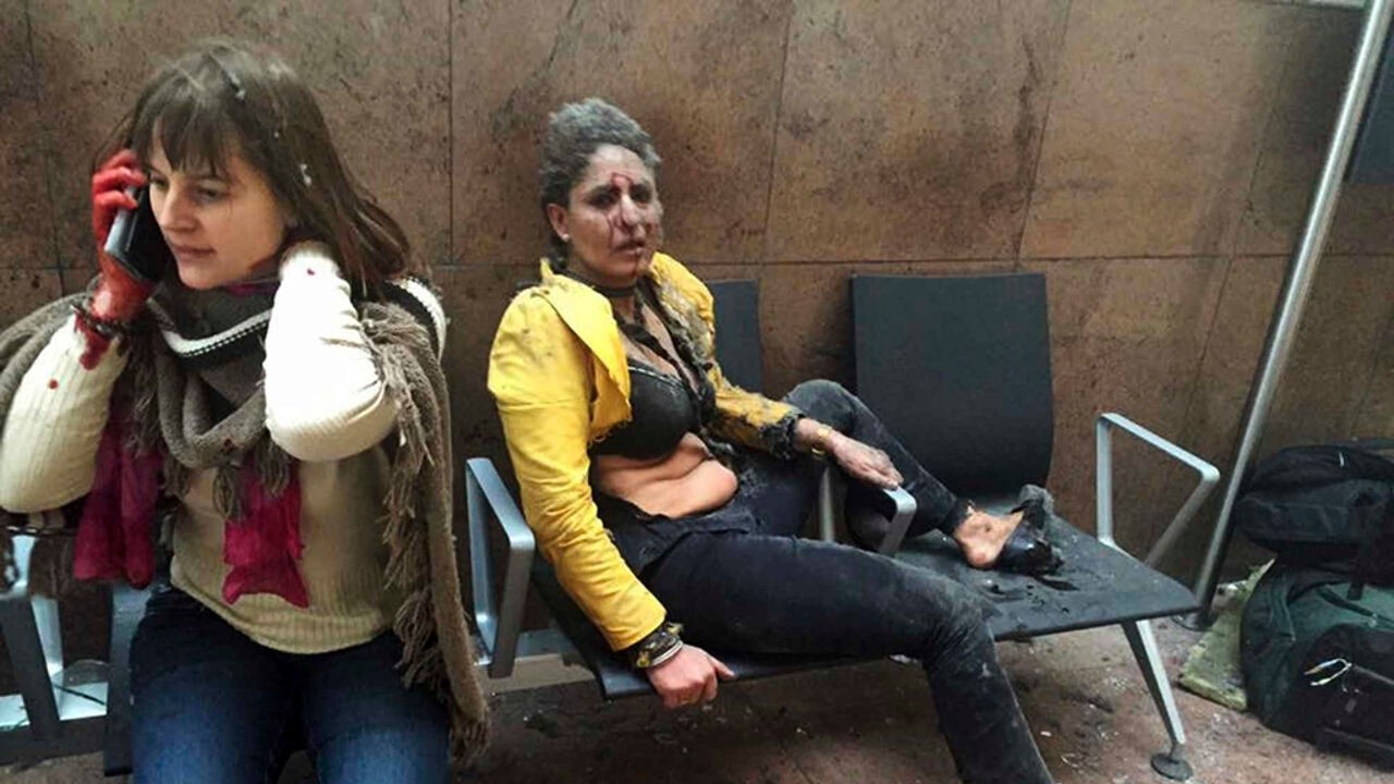 Foto van zwaargewonde stewardess Nidhi ging de wereld rond na aanslagen: "Ik moest meer dan 24 operaties ondergaan"