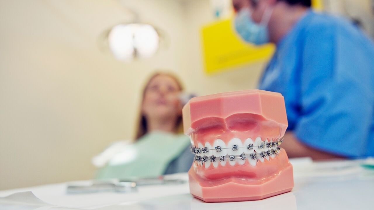 "Waar vind je op tijd geconventioneerde orthodontist?": zo denken ouders Greet, Maja en Dirk over nieuwe 'beugelregeling' van Vandenbroucke