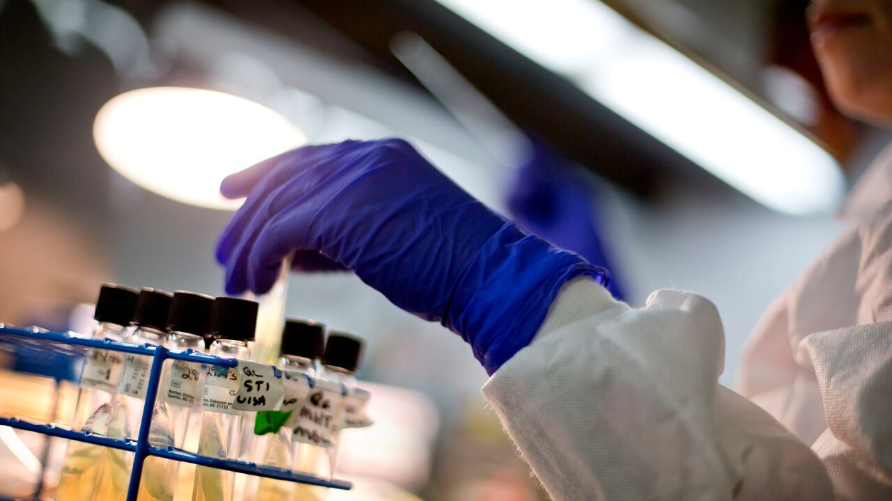 Russische laborante (28) overlijdt nadat reageerbuis met pestbacteriën breekt, 200 mensen in quarantaine