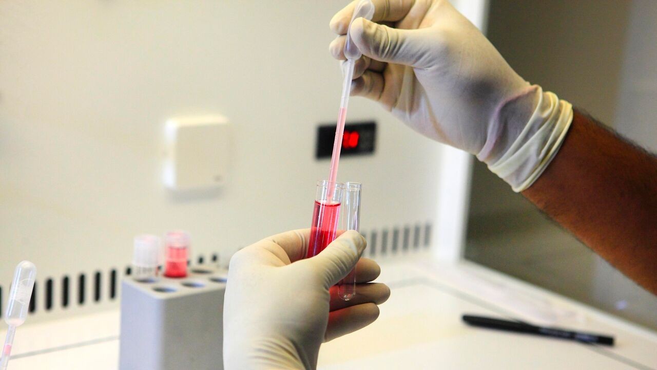 Nieuwe Leuvense DNA-test spoort daders seksueel misbruik op, zelfs wanneer er amper sporen zijn