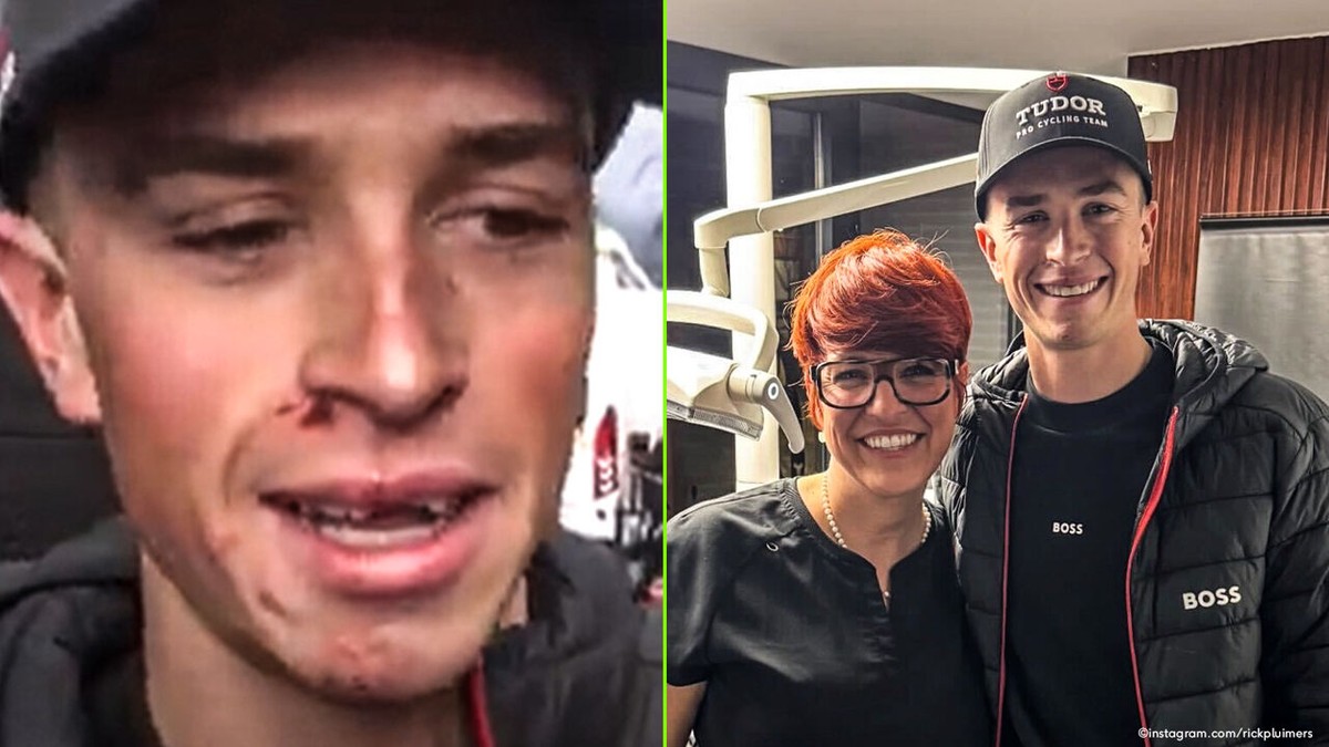 Amper 5 uur na zijn smak op de Molenberg: Rick Pluimers heeft zijn tanden al terug (dankzij vrouw van verzorger)