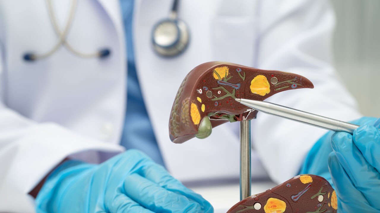 "Stille epidemie": minstens de helft van de mensen met leververvetting weet dat zelf niet