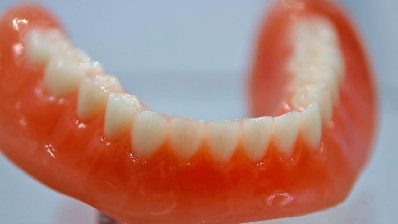 Mysterieus onderzoek in Duitse stad: voorbijganger vindt 35 tanden op straat