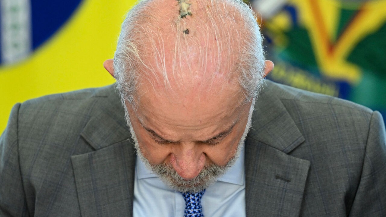 Vroege vorm van huidkanker vastgesteld bij Braziliaanse president Lula da Silva