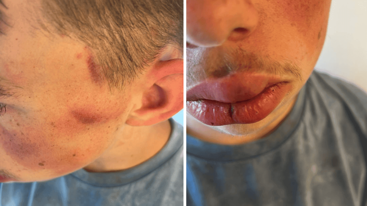 Twee minderjarigen uit Menen opgepakt na zware mishandeling van jongen met beperking in Wevelgem