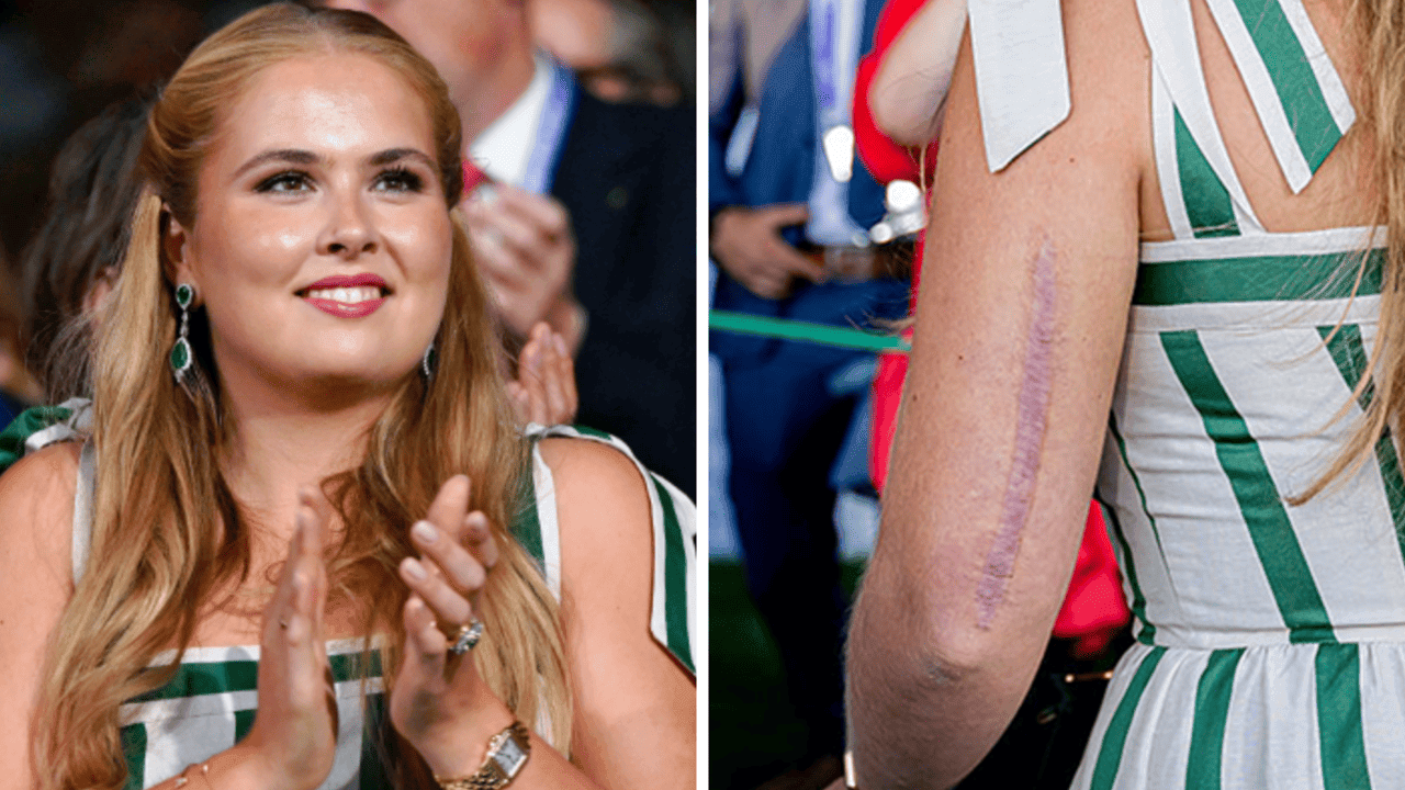 Nederlandse kroonprinses Amalia toont voor het eerst litteken van valpartij met paard Mojito