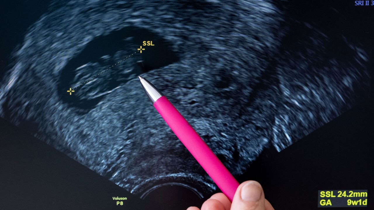 Abortustermijn verlengen tot 14 weken? "Sommige politici steken hun kop in het zand"