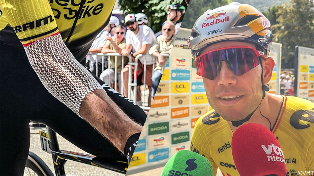 Gehavende Wout van Aert aan de start: "Ben maandag gevallen met de tijdritfiets, maar schade valt mee"