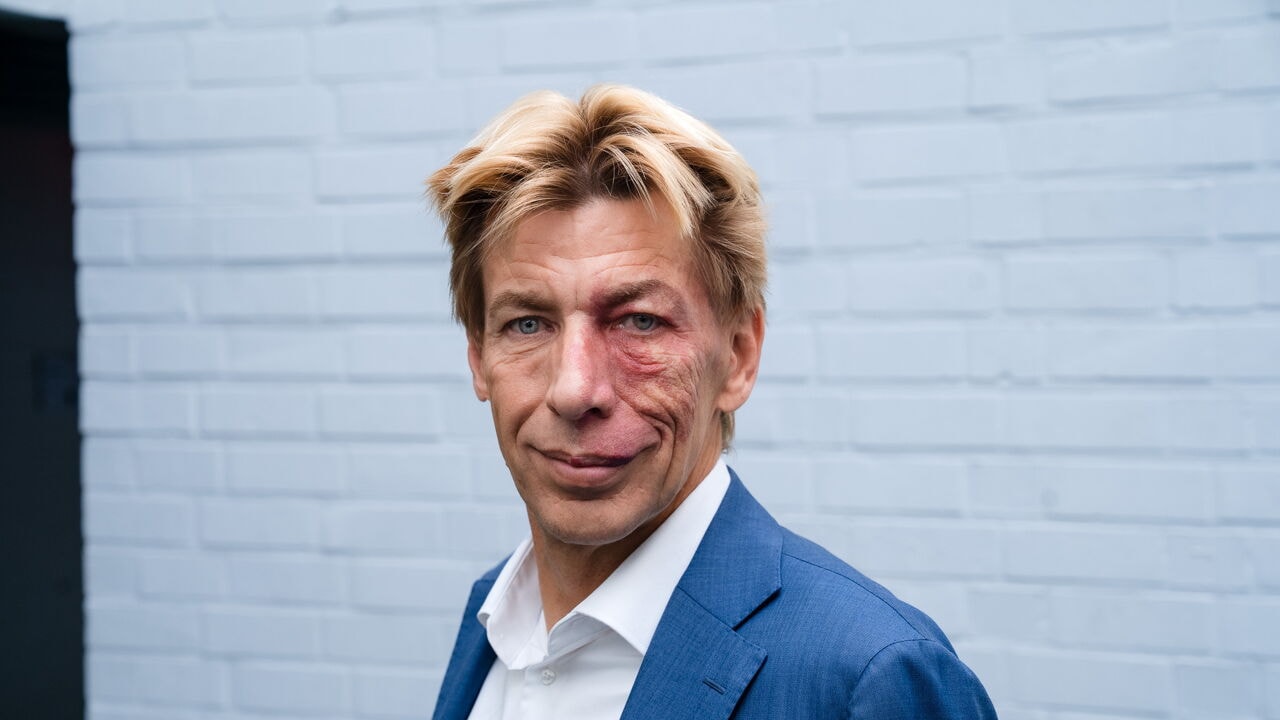 Bpost-CEO Chris Peeters voelt nog altijd impact van pesten: "Spreken voor groot publiek blijft uitdaging"
